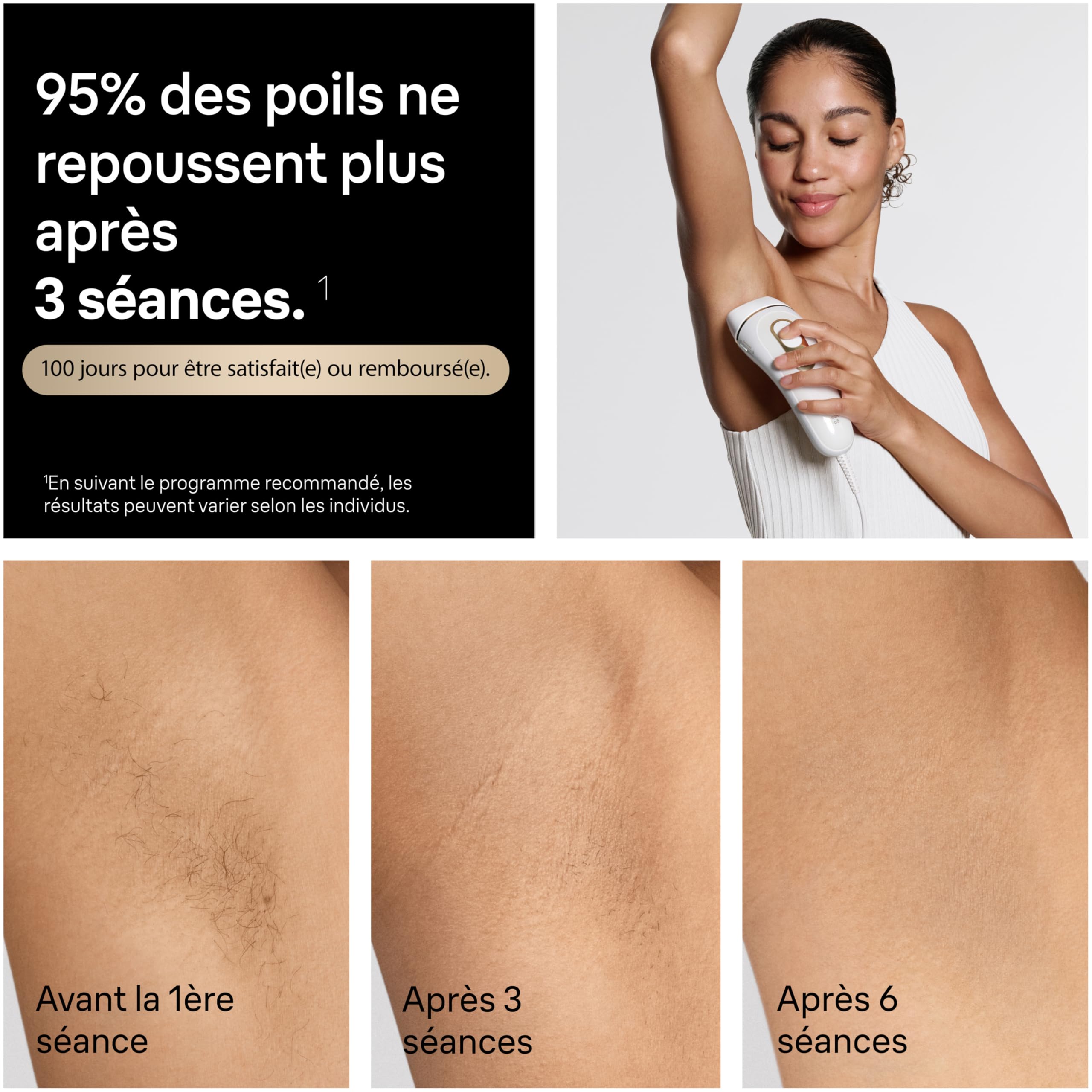 braun-silk-expert-pro-5-pl5100-pilateur-lumi-re-puls-e-blanc-et-or-alternative-a image 4