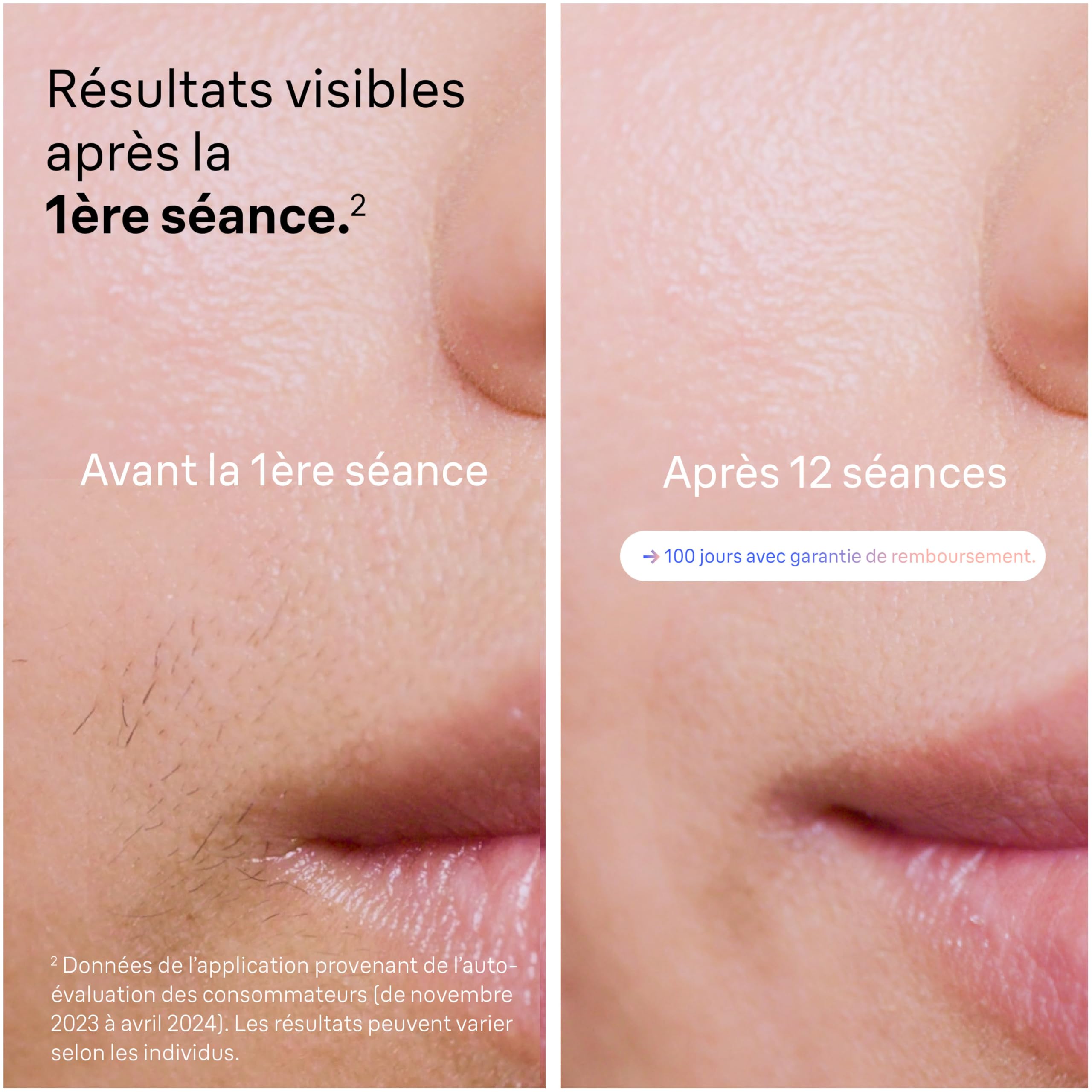 braun-skin-i-expert-pl7387-pilateur-lumi-re-puls-e-ipl-intelligent-avec-appli-4- image 4