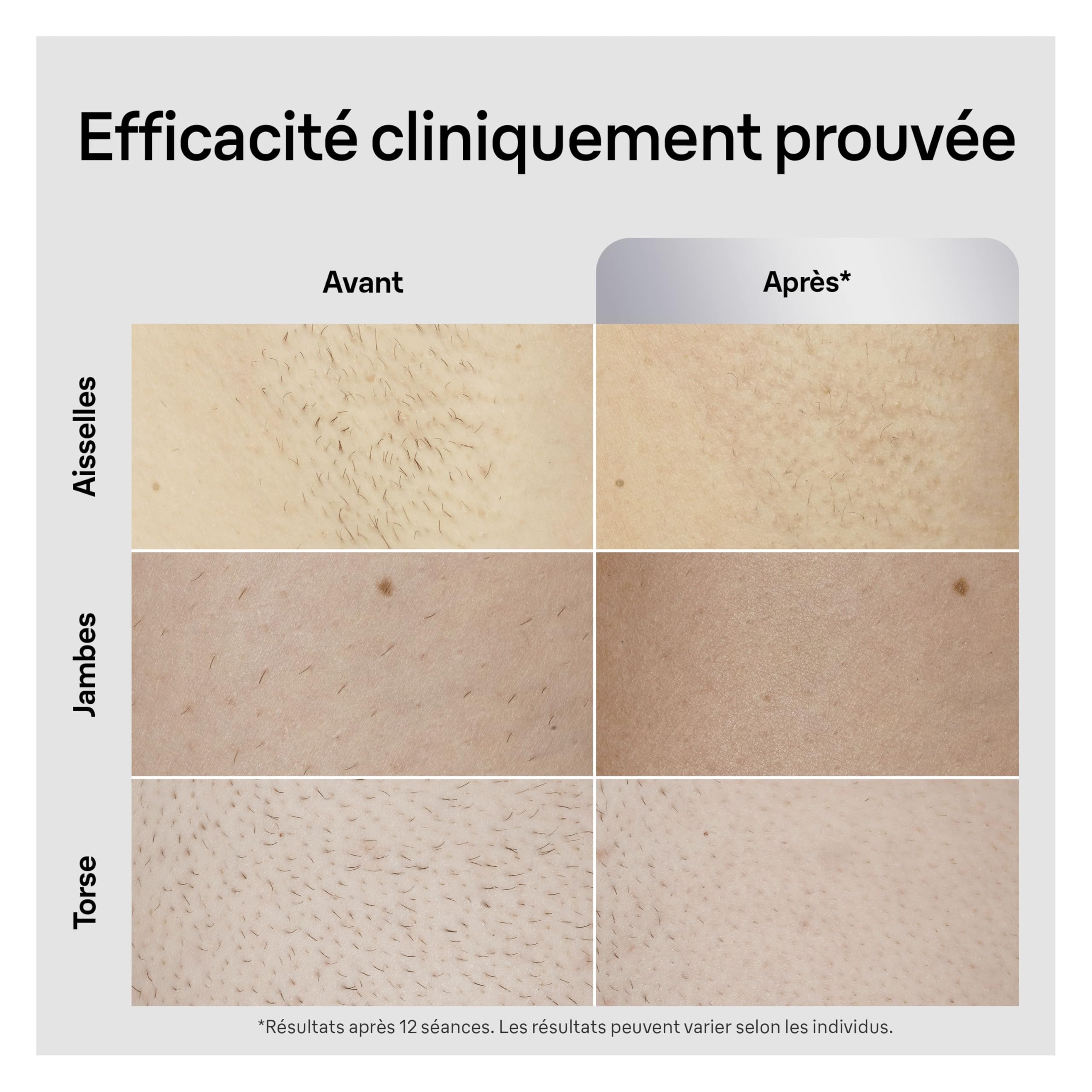 braun-silk-expert-pro-5-pilateur-lumi-re-puls-e-ipl-pilation-semi-d-finitive-alt image 6