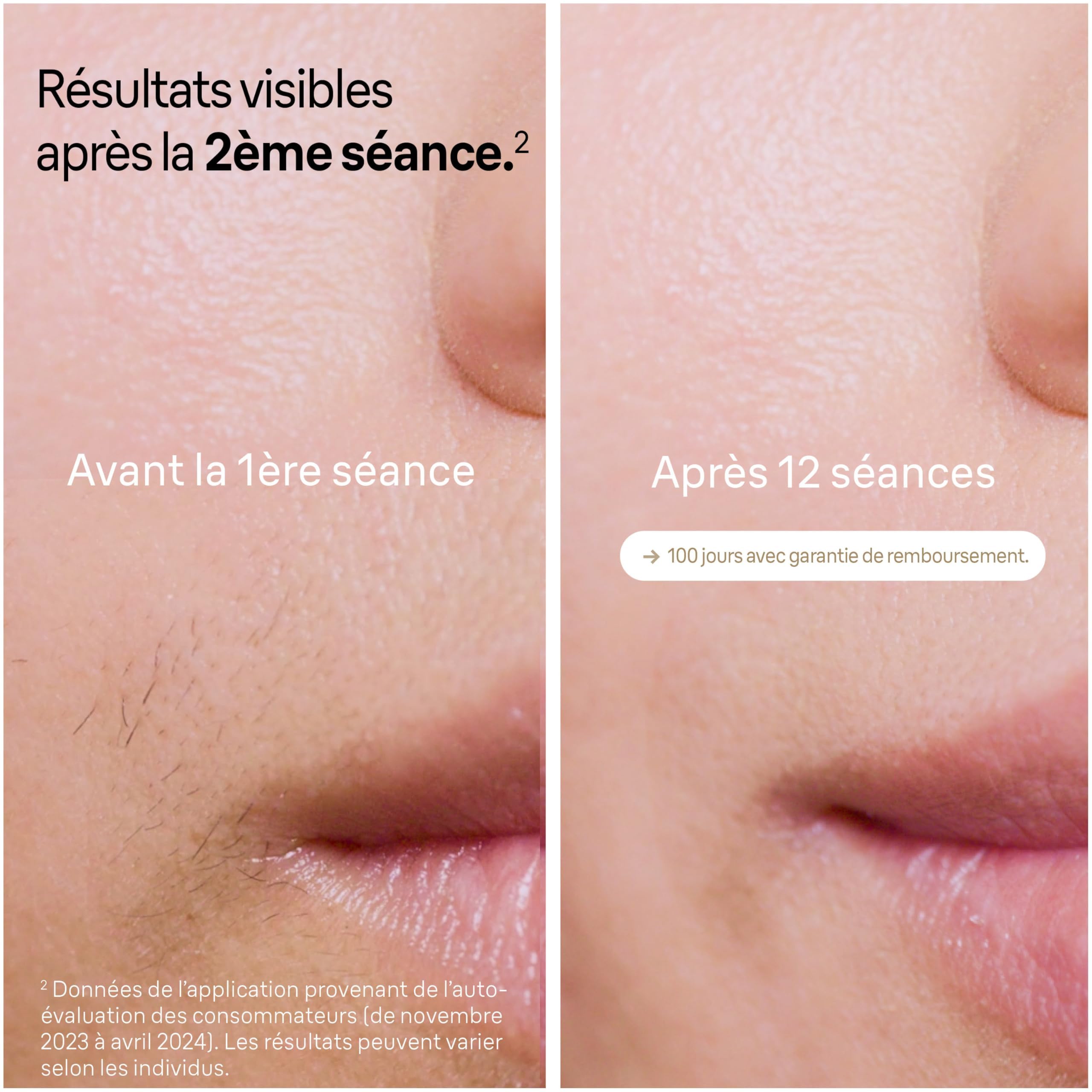 braun-silk-expert-pro-5-pl5358-pilateur-lumi-re-puls-e-ipl-avec-rasoir-venus-4-t image 3